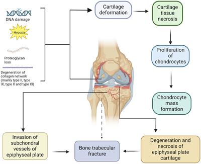 Effects of selenium and iodine on Kashin-Beck disease: an updated review